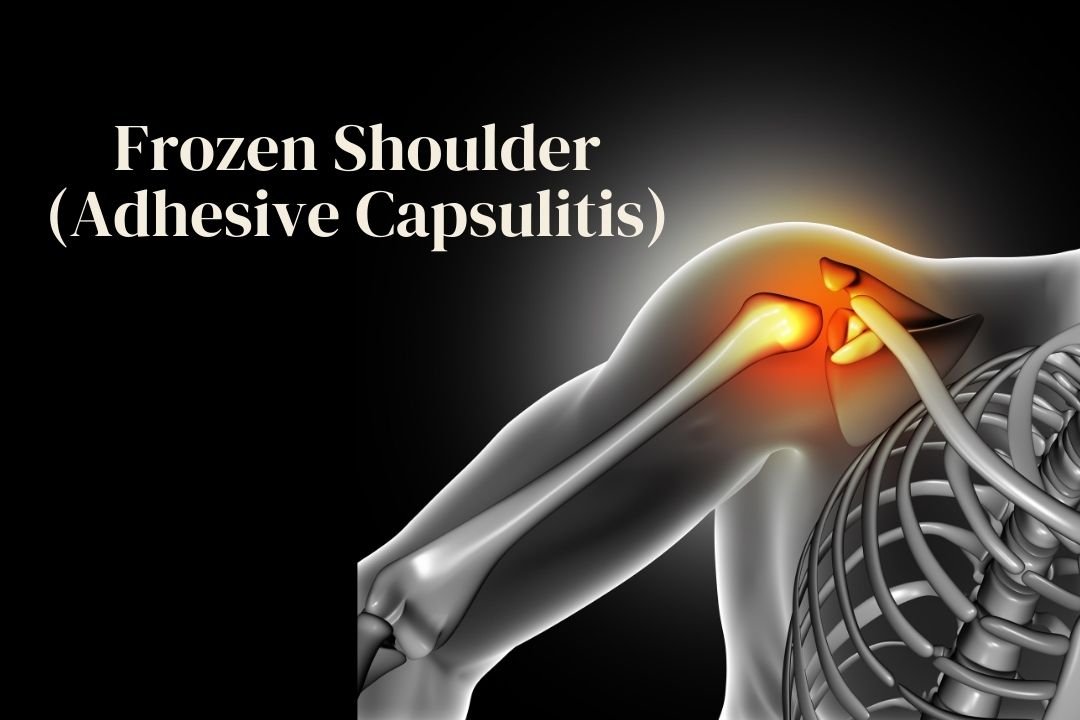 Frozen Shoulder Treatment in Hyderabad