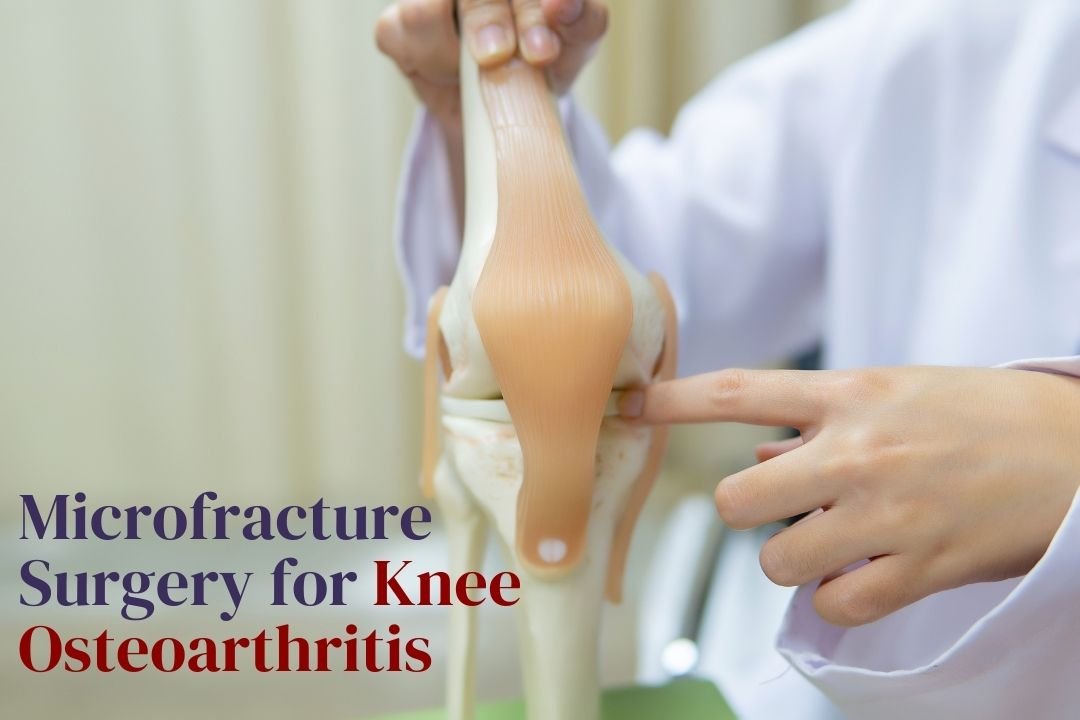 Microfracture Surgery For Knee Osteoarthritis in hyderabad