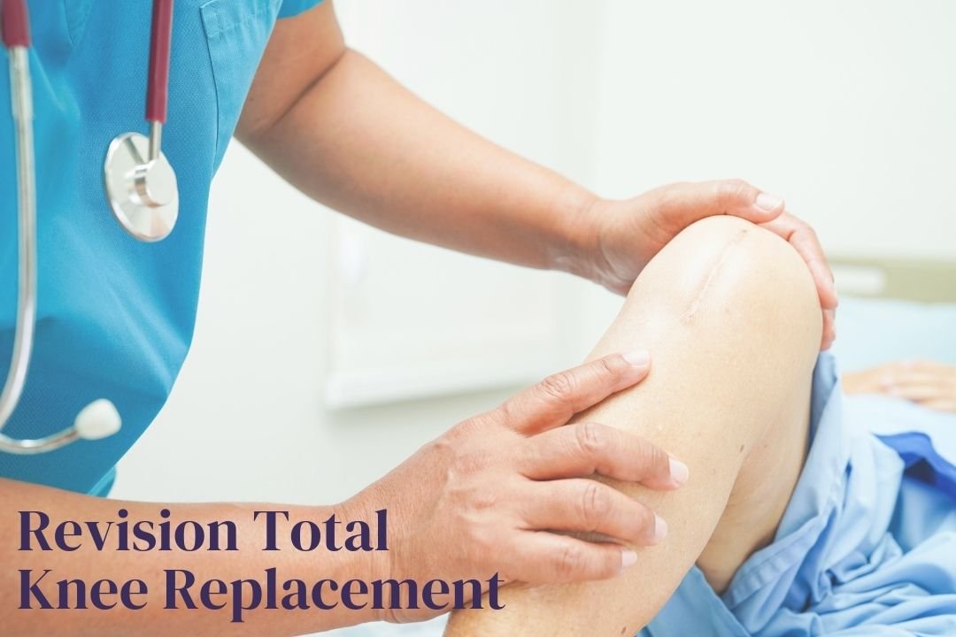 Revision Total Knee Replacement in hyderabad