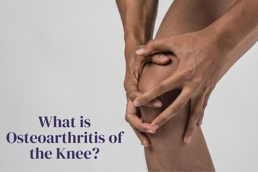 What Is Osteoarthritis Of The Knee